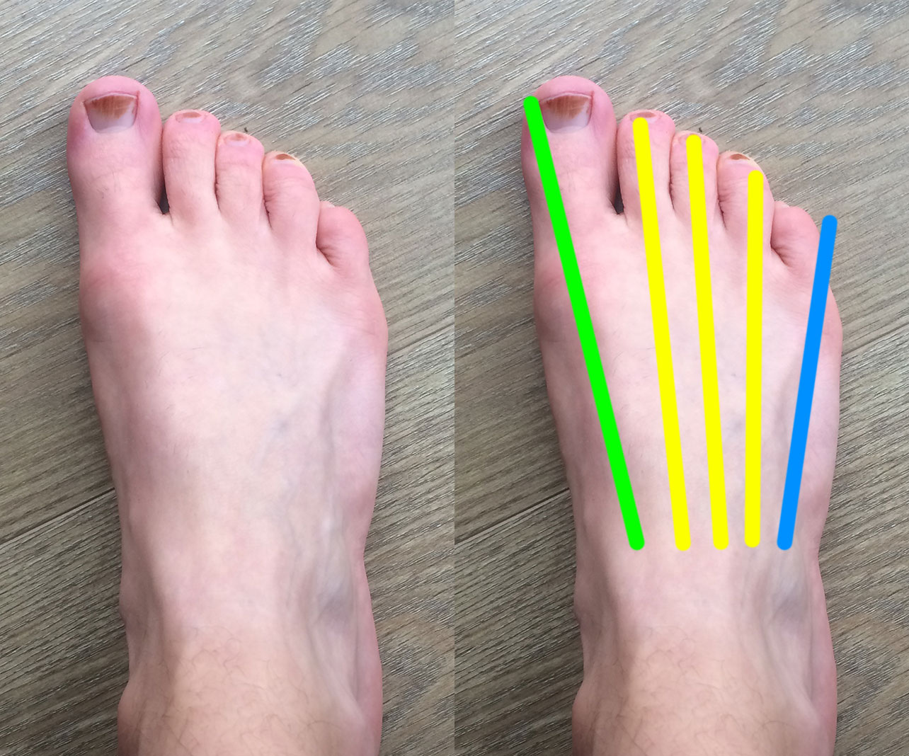 My toes and correct bones diagram